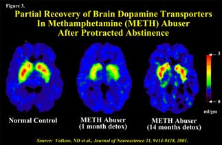 additional brain scans showing some recovery from methamphetamine abuse - in text