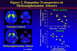 brain scans showing change in brain activity in methamphetamine abusers - in text