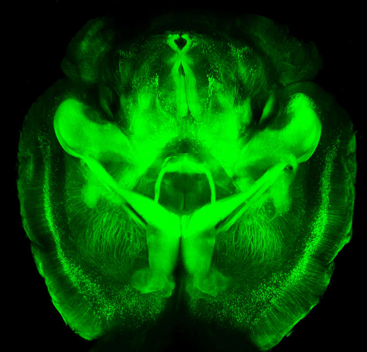 Mouse brain imaged using CLARITY.   Howard Hughes Medical Institute/Stanford University