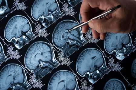 Mri brain scans with hand and pen pointing to image