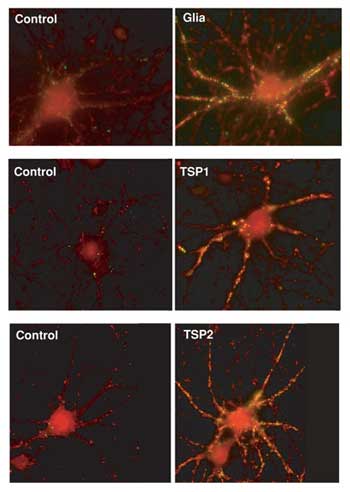 Photo Collage - Proteins Produced by Glial Cells Are Crucial to Development of Synapses