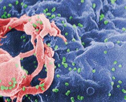 image of HIV virus