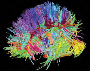 This image shows the many different white-matter fiber tracts as brightly colored lines in the human brain.