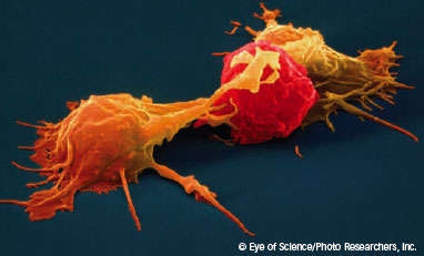 image of natural killer cells attacking a cancer cell
