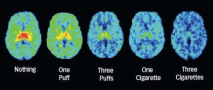 PET scans showing nicotine receptor saturation from one puff, three puffs, one cigarette and three cigarettes.