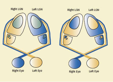 Illustration of connection between eye and lateral geniculate nucleus showing how some section receive input from one eye and some part receive input from both eyes - see caption