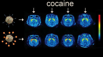 The key experiment used positron emission tomography (PET) to measure the level of DAT occupancy in the brain reward center of four different cocaine-injected animals after immunization with a naked (top) or cocaine analog-loaded (bottom) adenovirus particle. 