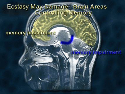 Long-term ecstasy use may impair memory