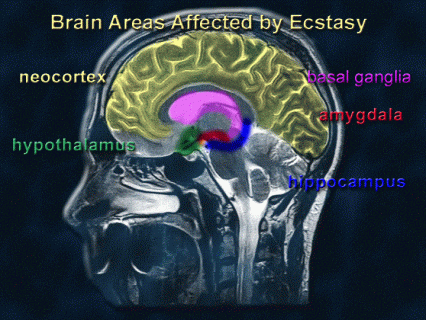 Brain areas sensitive to ecstasy