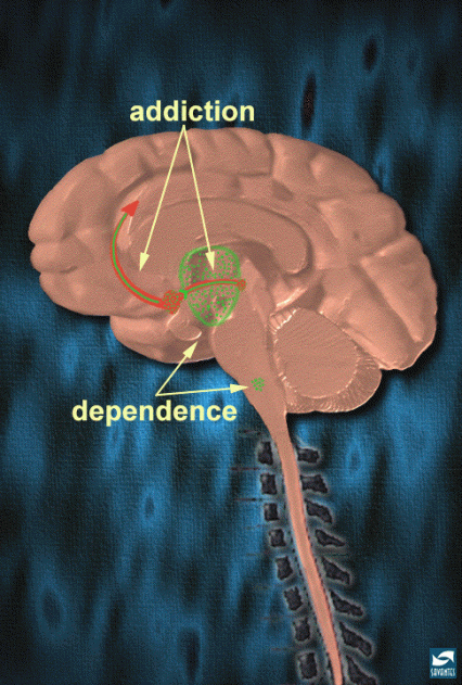 Illustration showing parts of the brain responsible for the addiction and dependence to heroin and opioids.