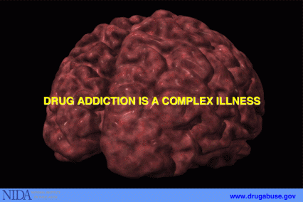 Image of brain with text overlay: Drug Addiction is a complex illness