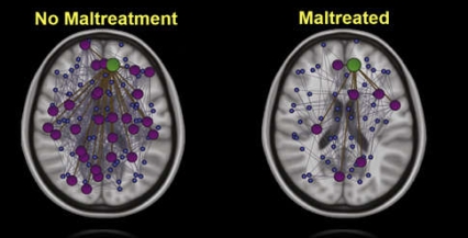 Two brain scans labeled “No Maltreatment” and “Maltreated”