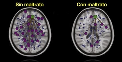 Imágenes escaneadas de dos cerebros con las etiquetas “Sin maltrato” y “Con maltrato” 