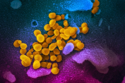 Image of SARS-CoV-2 (yellow), the virus that causes COVID-19.