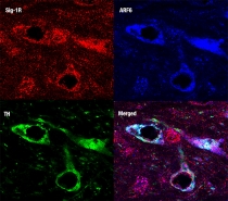 Chemical dyes identify key proteins for assembly and release of extracellular vesicles and dopamine synthesis in nerve cells in the mouse brain.