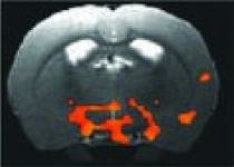Rat brain image showing hypothalamic and amygdala nuclei associated with conditioned heroin withdrawal.