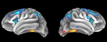Brain images showing activity in different regions of the brain