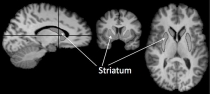 Brain striatum